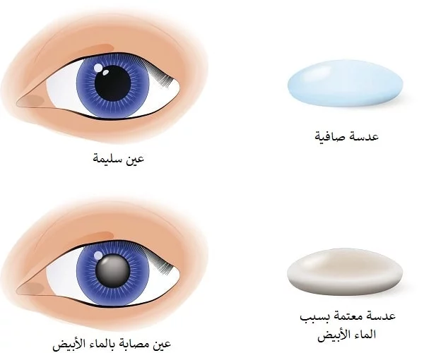 سحب الماء الابيض في ايران 2 1000181193.jpg