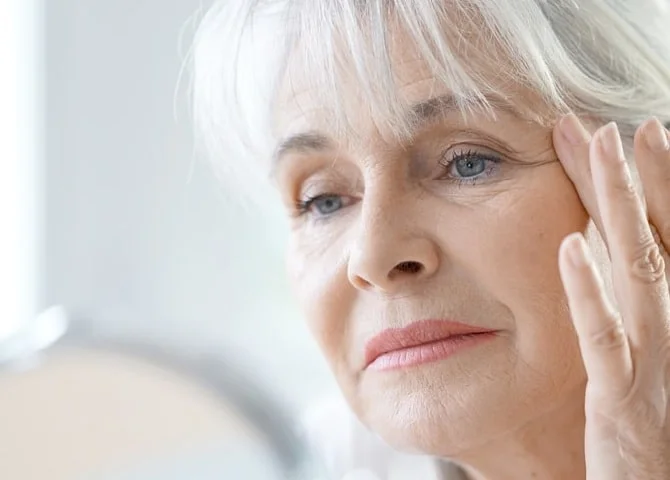 تجميل العيون في ايران 2 treatment for eye deformities 1.jpg