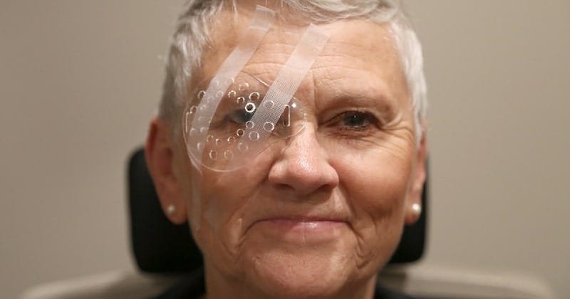 cataract surgery transparent shield