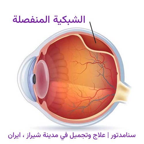 إزالة زيت السيليكون من العين: التحضير والمتابعة 1 إزالة زيت السيليكون من العين: التحضير والمتابعة